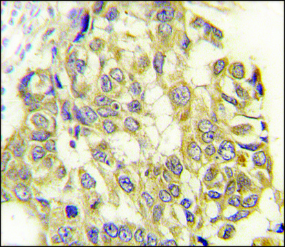 Anti-Semaphorin 3E(Sema3e) (C-term) antibody produced in rabbit IgG fraction of antiserum, buffered aqueous solution