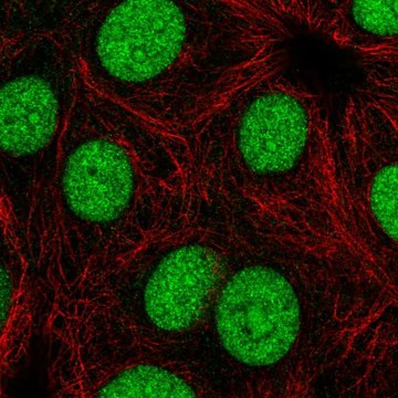 Anti-Ccny Antibody Produced In Rabbit Prestige Antibodies&#174; Powered by Atlas Antibodies, affinity isolated antibody, buffered aqueous glycerol solution