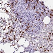 Anti-CD177 antibody produced in rabbit Prestige Antibodies® Powered by Atlas Antibodies, affinity isolated antibody
