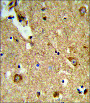 ANTI-ENTPD2 (N-TERM) antibody produced in rabbit IgG fraction of antiserum, buffered aqueous solution