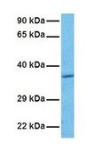 Anti-ASGR2 (AB2) antibody produced in rabbit IgG fraction of antiserum