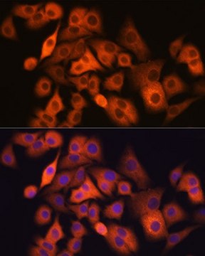 Anti-ALDH1A1 antibody produced in rabbit