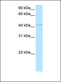 Anti-DPH1 antibody produced in rabbit affinity isolated antibody