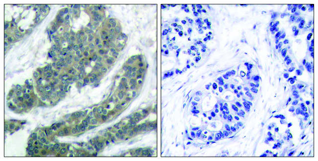 Anti-P62 DOK antibody produced in rabbit affinity isolated antibody