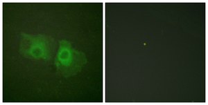 Anti-Keratin 18 antibody produced in rabbit affinity isolated antibody