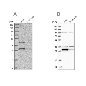 Anti-PPTC7 antibody produced in rabbit Prestige Antibodies&#174; Powered by Atlas Antibodies, affinity isolated antibody, buffered aqueous glycerol solution