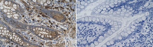 Anti-&#945;-Actinin-1 Antibody, clone 2C17 ZooMAb&#174; Rabbit Monoclonal recombinant, expressed in HEK 293 cells