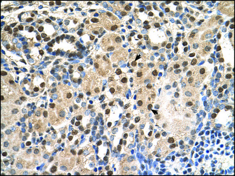 Anti-ANP32E antibody produced in rabbit affinity isolated antibody