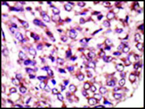 Anti-MGAT1 (N-term) antibody produced in rabbit IgG fraction of antiserum, buffered aqueous solution