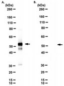 Anti-SARS-CoV-2 nucleocapsid Antibody, clone 5B9-C6