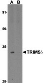 Anti-TRIM5 delta antibody produced in rabbit affinity isolated antibody