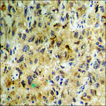 Anti-phospho-Casein Kinase II &#945; (pTyr255) antibody produced in rabbit affinity isolated antibody