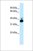 Anti-ALDOB antibody produced in rabbit affinity isolated antibody
