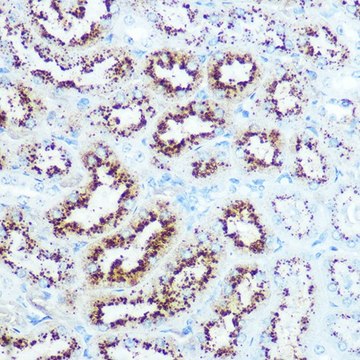 Anti-IGF1 antibody produced in rabbit