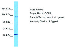 Anti-COPA antibody produced in rabbit affinity isolated antibody