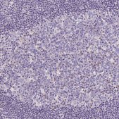 Anti-LRRC26 antibody produced in rabbit Prestige Antibodies® Powered by Atlas Antibodies, affinity isolated antibody, buffered aqueous glycerol solution