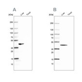 Anti-FAH antibody produced in rabbit Prestige Antibodies® Powered by Atlas Antibodies, affinity isolated antibody, buffered aqueous glycerol solution