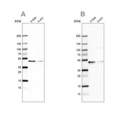 Anti-EPHX1 antibody produced in rabbit Prestige Antibodies® Powered by Atlas Antibodies, affinity isolated antibody, buffered aqueous glycerol solution