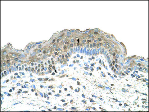 Anti-TAPBP antibody produced in rabbit affinity isolated antibody