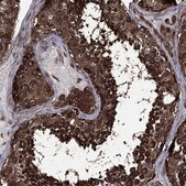 Anti-Eif2B4 Antibody Produced In Rabbit Prestige Antibodies® Powered by Atlas Antibodies, affinity isolated antibody, buffered aqueous glycerol solution