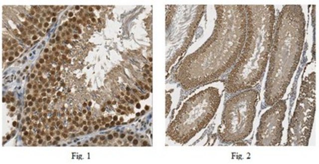 Anti-GLI1 Antibody from rabbit, purified by affinity chromatography