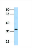 Anti-HADH antibody produced in rabbit affinity isolated antibody
