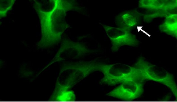 LentiBrite GFP-Tubulin Lentiviral Biosensor