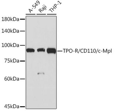 Anti-TPO-R/CD110/c-Mpl Antibody, clone 5Q9Z6, Rabbit Monoclonal