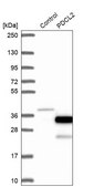 Anti-PDCL2 antibody produced in rabbit Prestige Antibodies® Powered by Atlas Antibodies, affinity isolated antibody, buffered aqueous glycerol solution