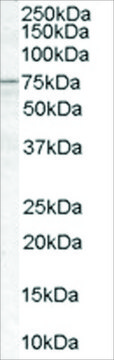 Anti-ACSL5 antibody produced in goat affinity isolated antibody, buffered aqueous solution