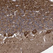 Anti-KRTAP27-1 antibody produced in rabbit Prestige Antibodies® Powered by Atlas Antibodies, affinity isolated antibody, buffered aqueous glycerol solution