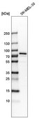 Anti-GYG2 antibody produced in rabbit Prestige Antibodies® Powered by Atlas Antibodies, affinity isolated antibody, buffered aqueous glycerol solution