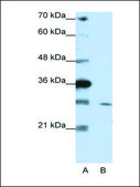 Anti-ZNF397 antibody produced in rabbit IgG fraction of antiserum