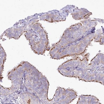 Anti-CEP164 antibody produced in rabbit Prestige Antibodies&#174; Powered by Atlas Antibodies, affinity isolated antibody, buffered aqueous glycerol solution