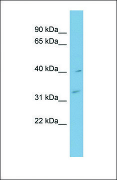 Anti-MYOZ1 antibody produced in rabbit affinity isolated antibody