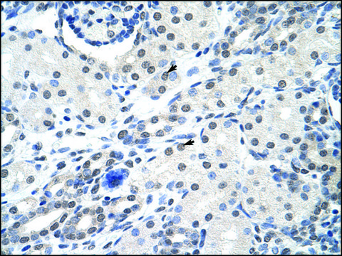 Anti-SNRPA antibody produced in rabbit affinity isolated antibody