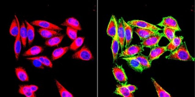 Anti-Vimentin Antibody, clone VIM 3B4 clone VIM 3B4, Chemicon&#174;, from mouse