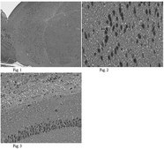 Anti-Alzheimer Precursor Protein A4 Antibody, clone 22C11, Biotin Conj. | MAB348B clone 22C11, from mouse, biotin conjugate