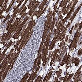 Anti-CHRNA1 antibody produced in rabbit Prestige Antibodies® Powered by Atlas Antibodies, affinity isolated antibody