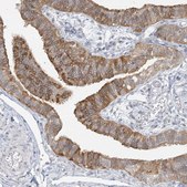 Anti-ANKS1A antibody produced in rabbit Prestige Antibodies® Powered by Atlas Antibodies, affinity isolated antibody, buffered aqueous glycerol solution