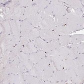 Anti-SAMHD1 antibody produced in rabbit Prestige Antibodies® Powered by Atlas Antibodies, affinity isolated antibody, buffered aqueous glycerol solution