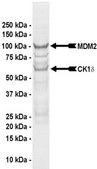 MDM2/CK1δ Protein, active, 10 µg Active, full length, recombinant human MDM2 (N-terminal GST-tagged) combined in vitro with CK1δ, active (Item # 14-520). For use in Enzyme Assays. Functions as an E3 ligase in ubiquitination assays.
