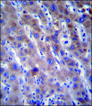 ANTI-FADS2 (N-TERM) antibody produced in rabbit IgG fraction of antiserum, buffered aqueous solution