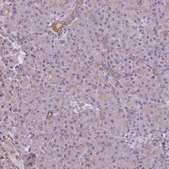 Anti-LYPLA1 antibody produced in rabbit Prestige Antibodies® Powered by Atlas Antibodies, affinity isolated antibody, buffered aqueous glycerol solution