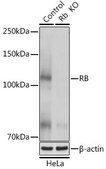 Anti- RB antibody produced in rabbit