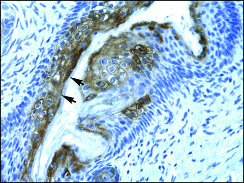 Anti-HDAC2 antibody produced in rabbit affinity isolated antibody