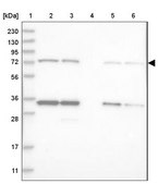 Anti-LSS antibody produced in rabbit Prestige Antibodies® Powered by Atlas Antibodies, affinity isolated antibody, buffered aqueous glycerol solution