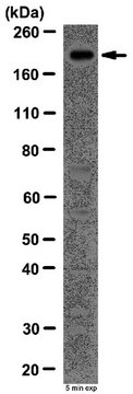 Anti-Methylcytosine dioxygenase TET1 Antibody from rabbit, purified by affinity chromatography