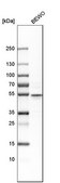Anti-CRISPLD2 antibody produced in rabbit Prestige Antibodies® Powered by Atlas Antibodies, affinity isolated antibody, buffered aqueous glycerol solution
