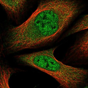 Anti-GLMN antibody produced in rabbit Prestige Antibodies&#174; Powered by Atlas Antibodies, affinity isolated antibody, buffered aqueous glycerol solution